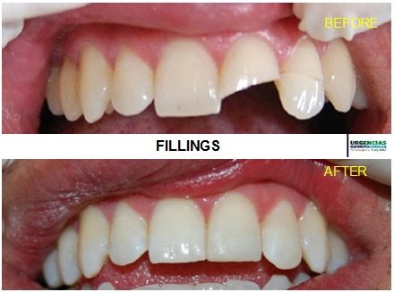 Urgencias Odontologicas 24 Horas - Urgencias Odontologicas 24 Horas