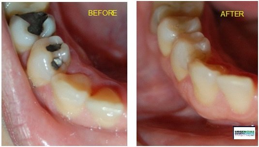 Urgencias Odontologicas 24 Horas - Urgencias Odontologicas 24 Horas