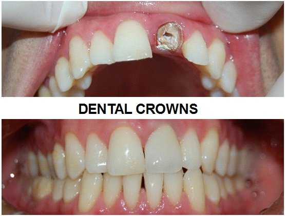 Urgencias Odontologicas 24 Horas - Urgencias Odontologicas 24 Horas
