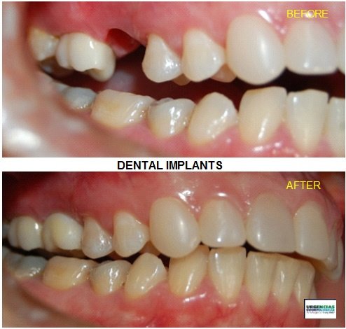 Urgencias Odontologicas 24 Horas - Urgencias Odontologicas 24 Horas