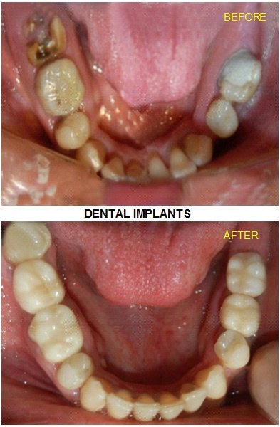 Urgencias Odontologicas 24 Horas - Urgencias Odontologicas 24 Horas