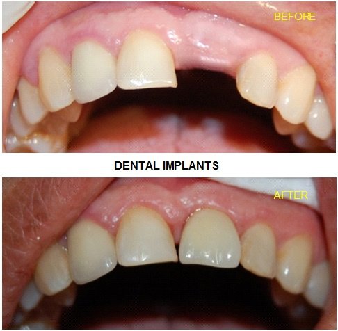 Urgencias Odontologicas 24 Horas - Urgencias Odontologicas 24 Horas
