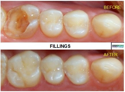 Urgencias Odontologicas 24 Horas - Urgencias Odontologicas 24 Horas