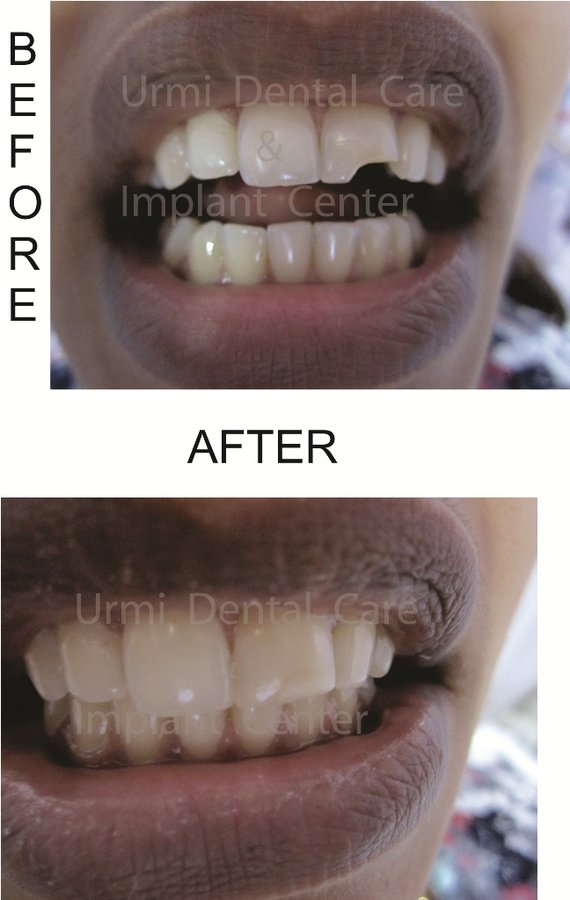 مركز أورمي للعناية بالأسنان - Urmi Dental Care Centre