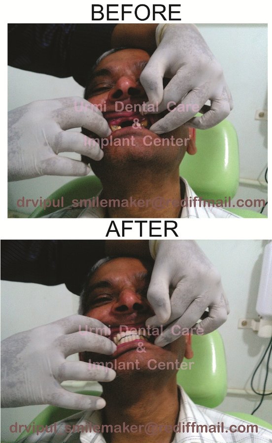 مركز أورمي للعناية بالأسنان - Urmi Dental Care Centre