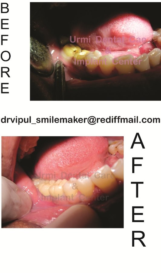 مركز أورمي للعناية بالأسنان - Urmi Dental Care Centre