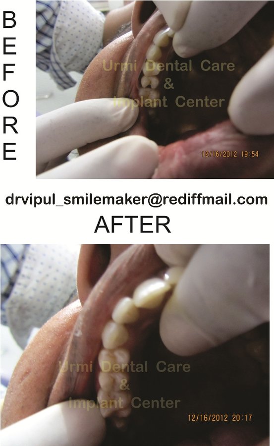 مركز أورمي للعناية بالأسنان - Urmi Dental Care Centre