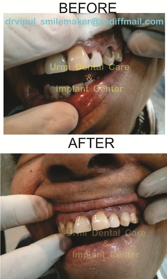 مركز أورمي للعناية بالأسنان - Urmi Dental Care Centre