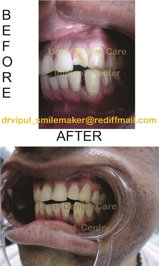 مركز أورمي للعناية بالأسنان - Urmi Dental Care Centre