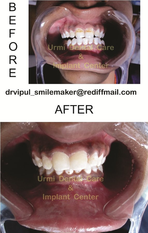 مركز أورمي للعناية بالأسنان - Urmi Dental Care Centre