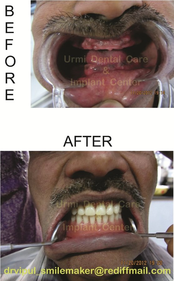 مركز أورمي للعناية بالأسنان - Urmi Dental Care Centre