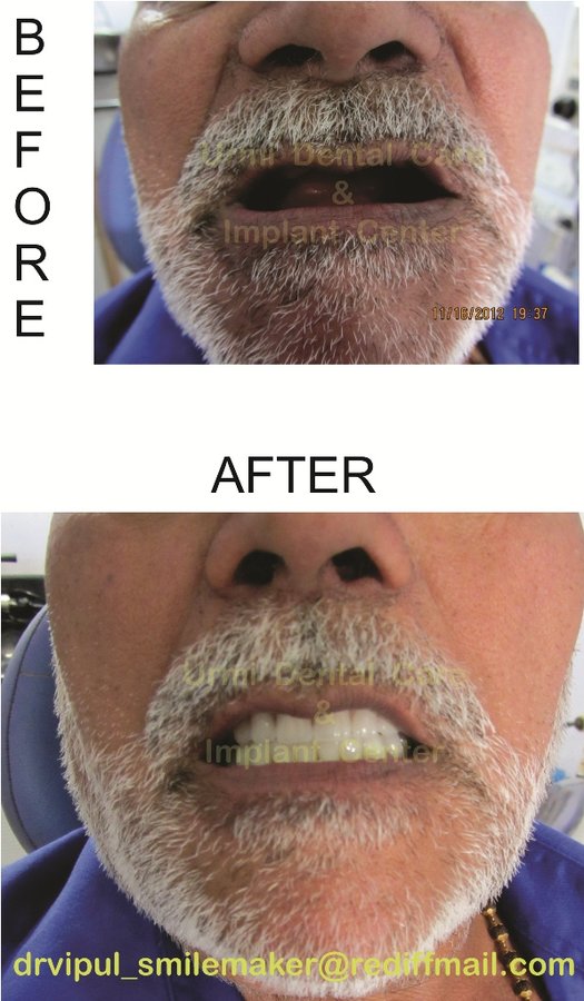 مركز أورمي للعناية بالأسنان - Urmi Dental Care Centre