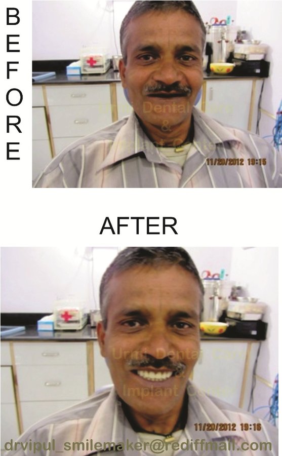 مركز أورمي للعناية بالأسنان - Urmi Dental Care Centre