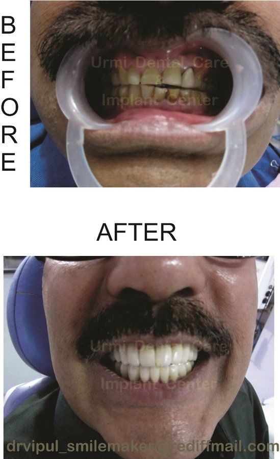 مركز أورمي للعناية بالأسنان - Urmi Dental Care Centre
