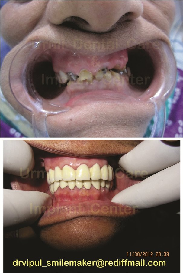 مركز أورمي للعناية بالأسنان - Urmi Dental Care Centre