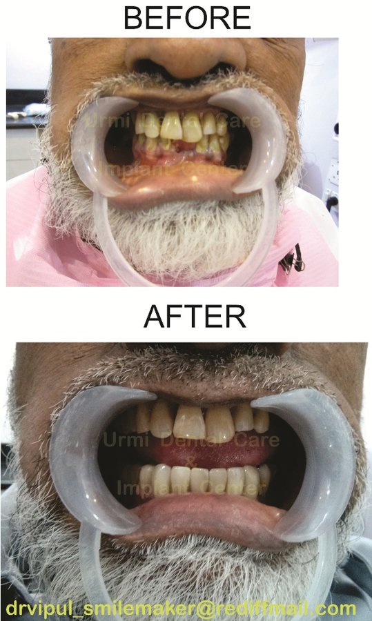 مركز أورمي للعناية بالأسنان - Urmi Dental Care Centre