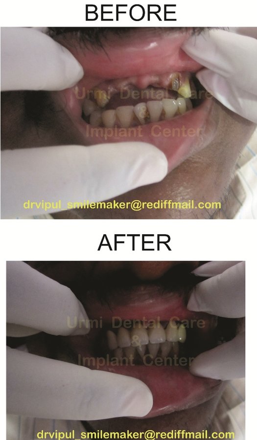 مركز أورمي للعناية بالأسنان - Urmi Dental Care Centre