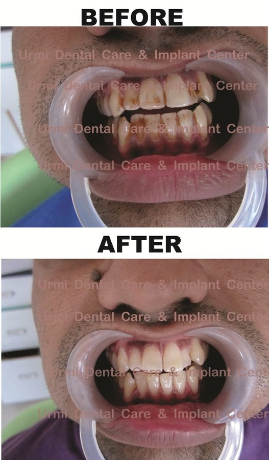 مركز أورمي للعناية بالأسنان - Urmi Dental Care Centre