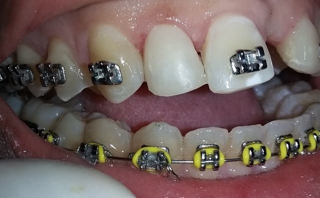 U-Smile Family Dental Practice - U-Smile Family Dental Practice