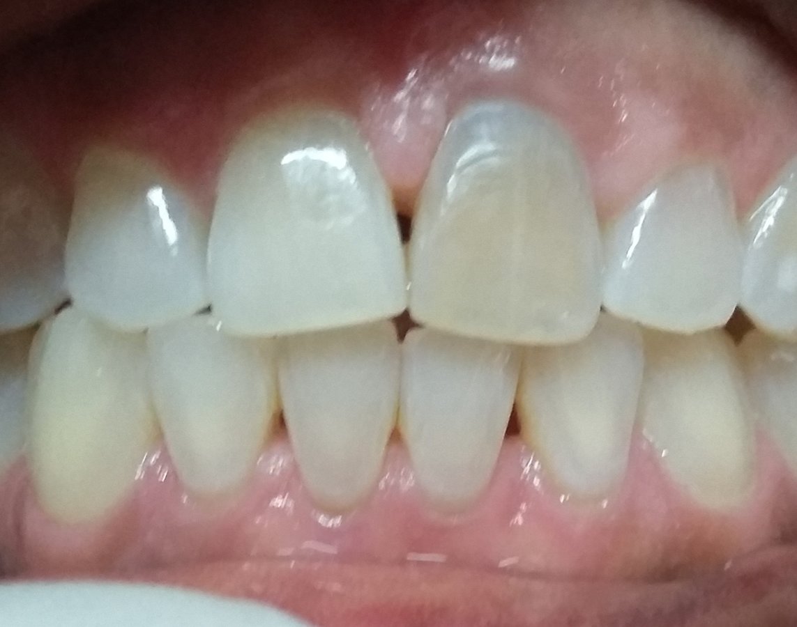 U-Smile Family Dental Practice - U-Smile Family Dental Practice