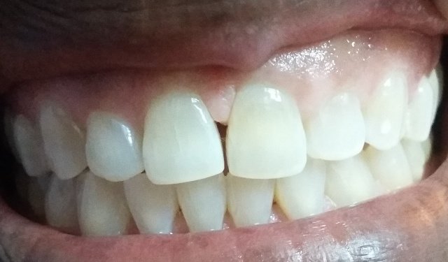 U-Smile Family Dental Practice - U-Smile Family Dental Practice