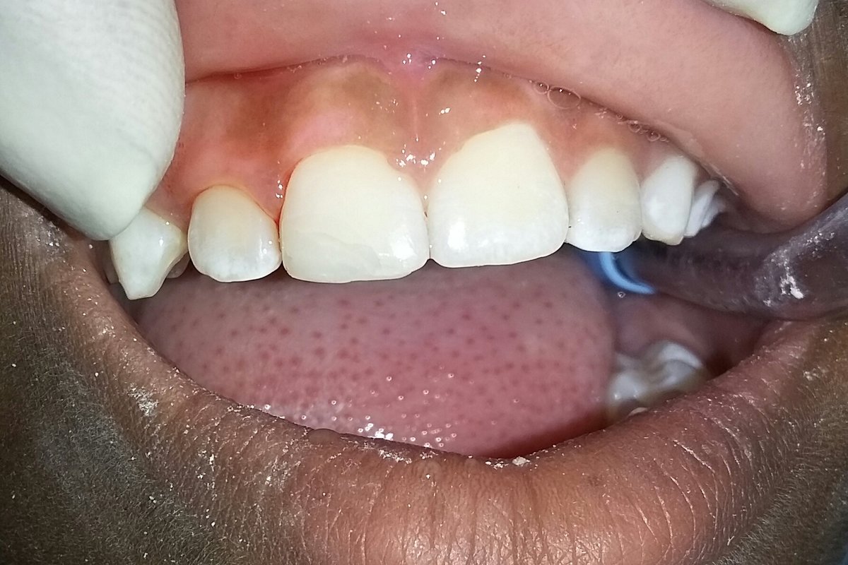 U-Smile Family Dental Practice - U-Smile Family Dental Practice