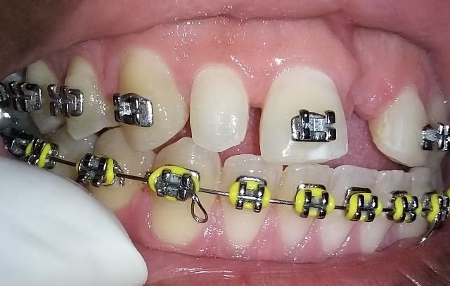 U-Smile Family Dental Practice - U-Smile Family Dental Practice