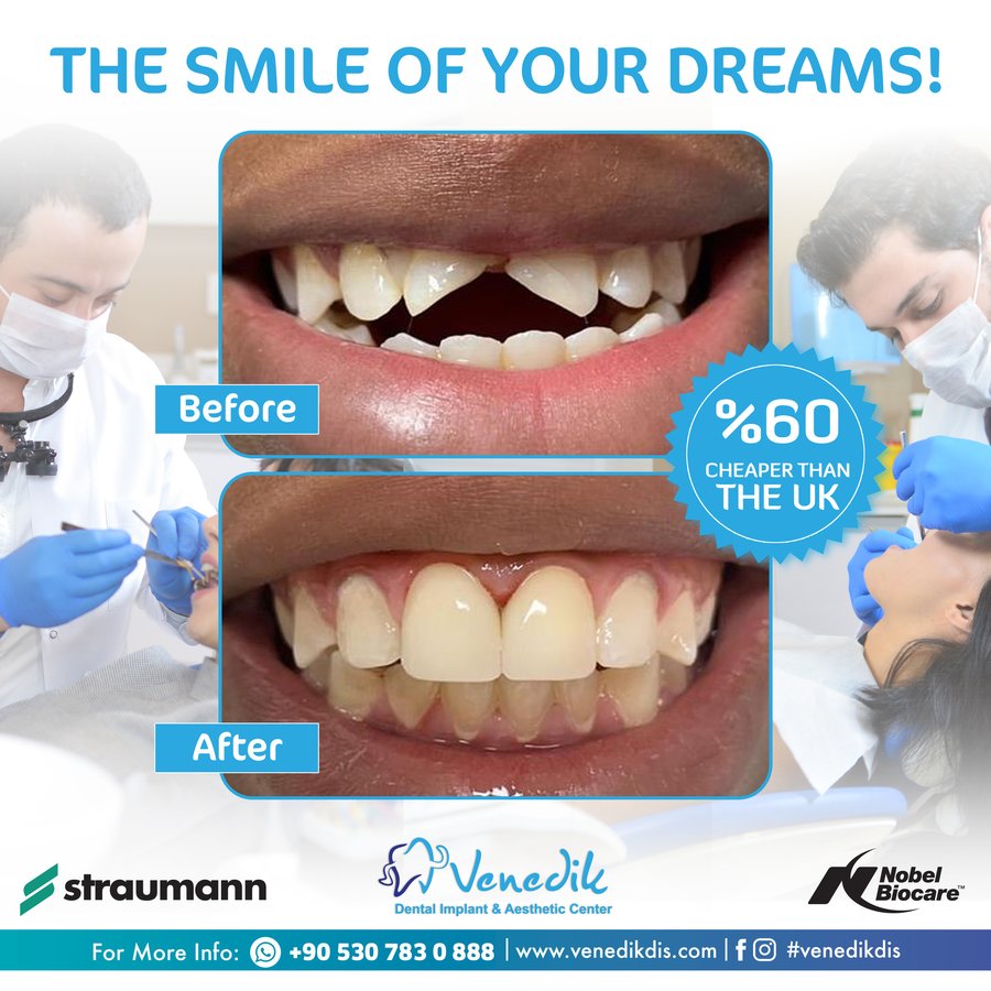 V Smile Centre - V Smile Centre
