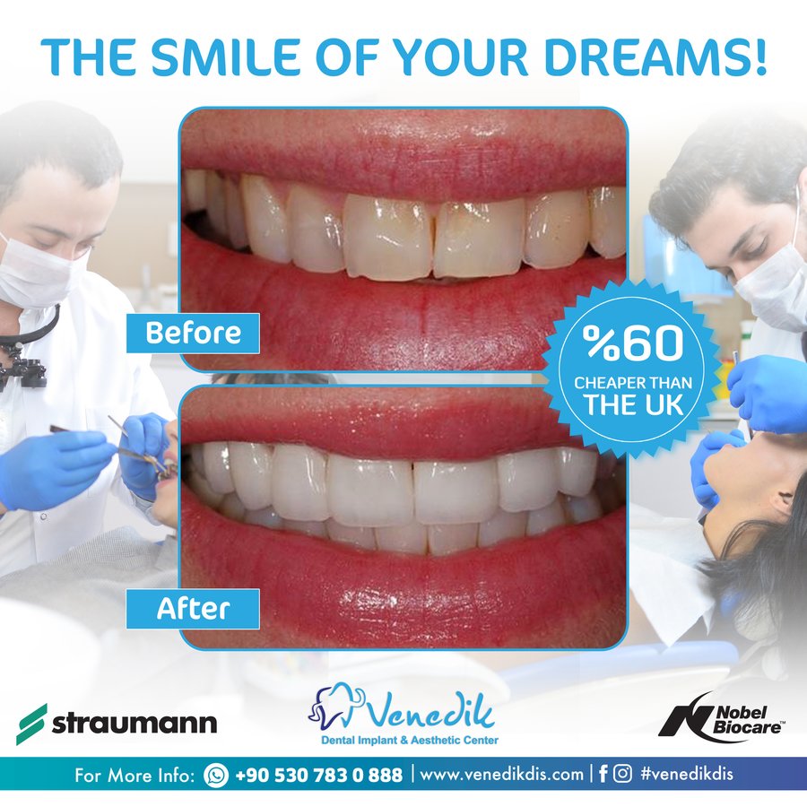 V Smile Centre - V Smile Centre