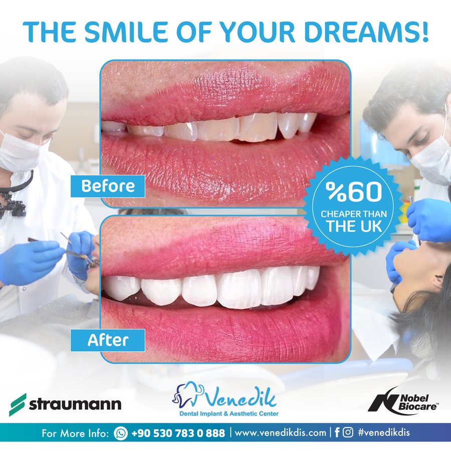 V Smile Centre - V Smile Centre