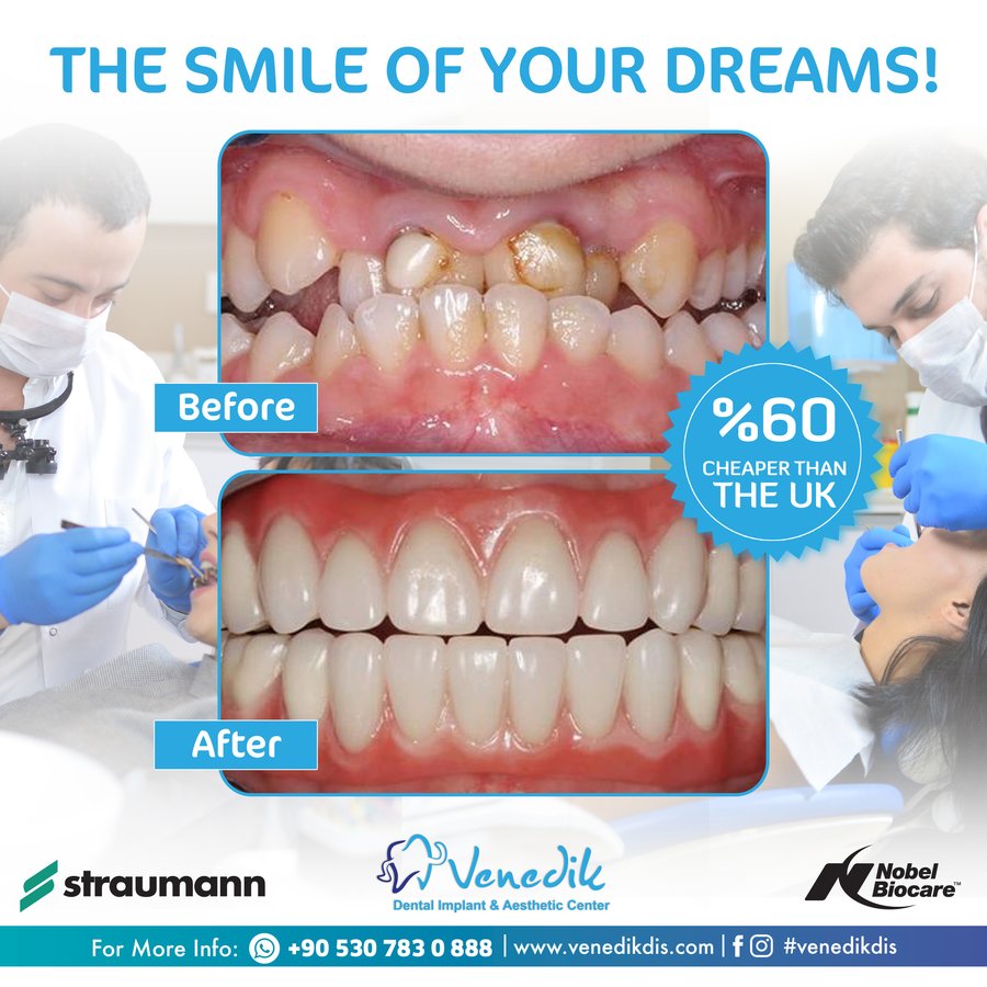 V Smile Centre - V Smile Centre
