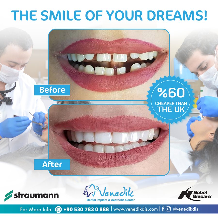 V Smile Centre - V Smile Centre