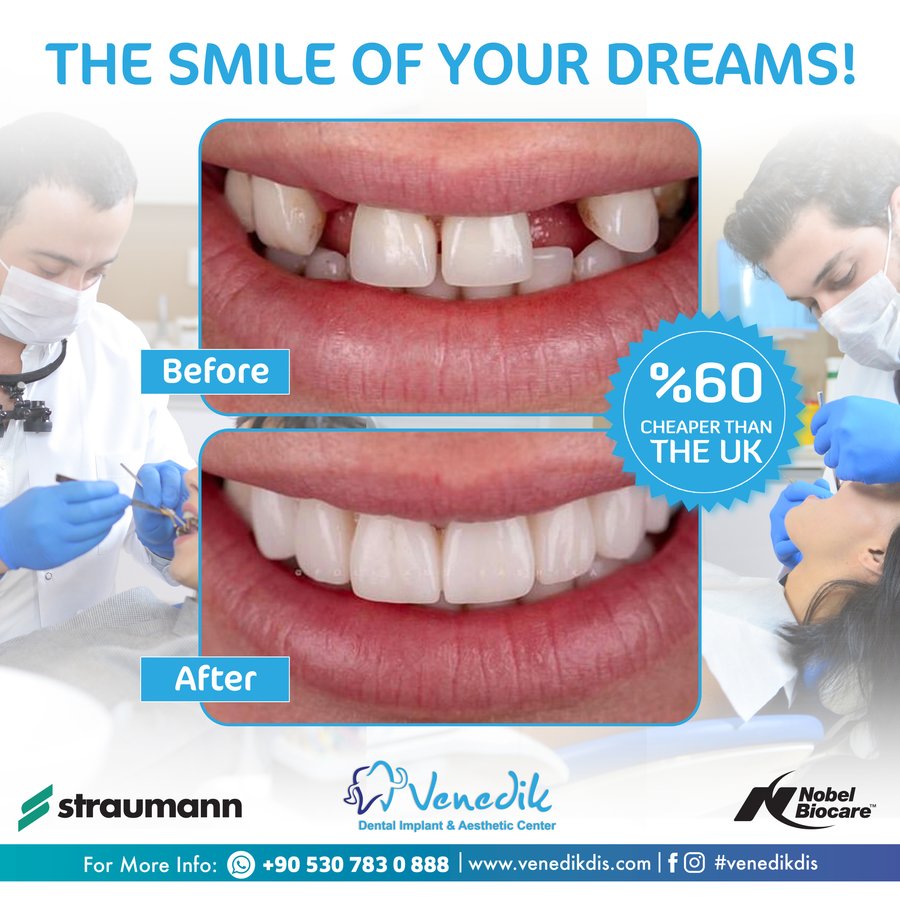 V Smile Centre - V Smile Centre
