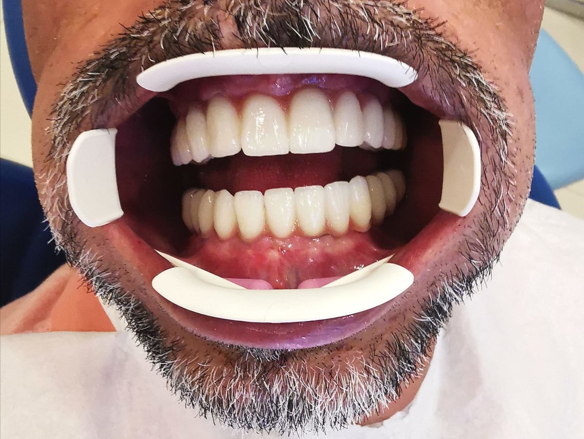 V Smile Centre - V Smile Centre