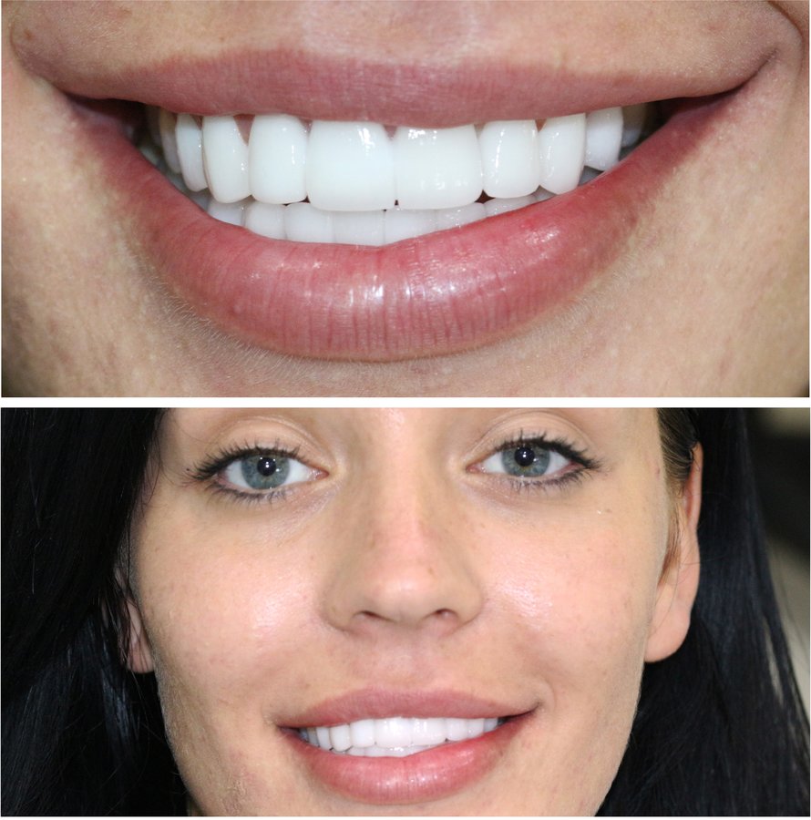 V Smile Centre - V Smile Centre