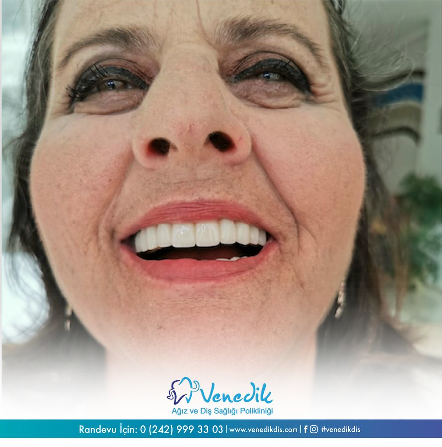 V Smile Centre - V Smile Centre