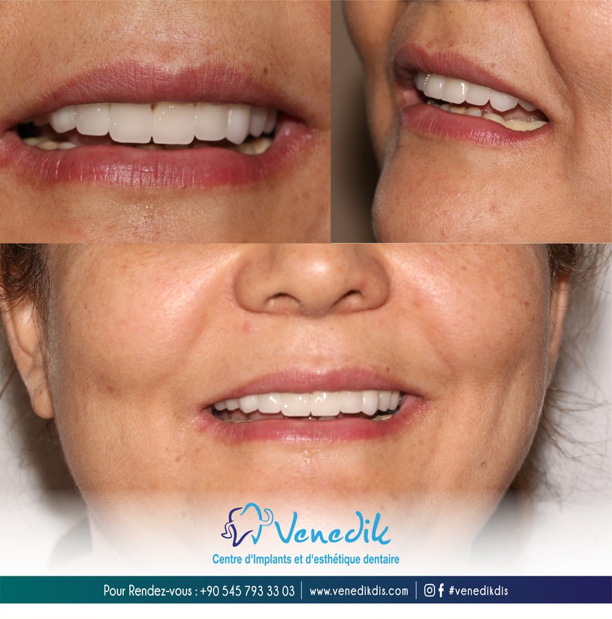 V Smile Centre - V Smile Centre