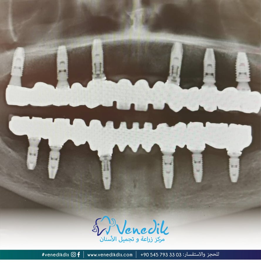 V Smile Centre - V Smile Centre