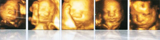 Valencia Center for Women's Health: Navid Navizade - Valencia Center for Women's Health: Navid Navizade