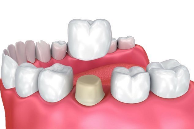 Valley Dental - Valley Dental