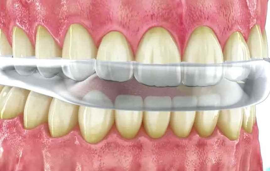 Valley Dental - Valley Dental