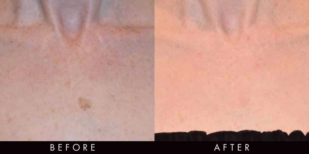 Vamp Cosmetic Clinic - Vamp Cosmetic Clinic