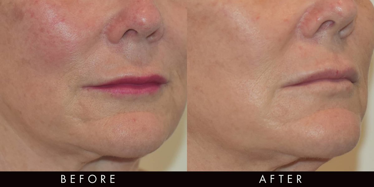 Vamp Cosmetic Clinic - Vamp Cosmetic Clinic