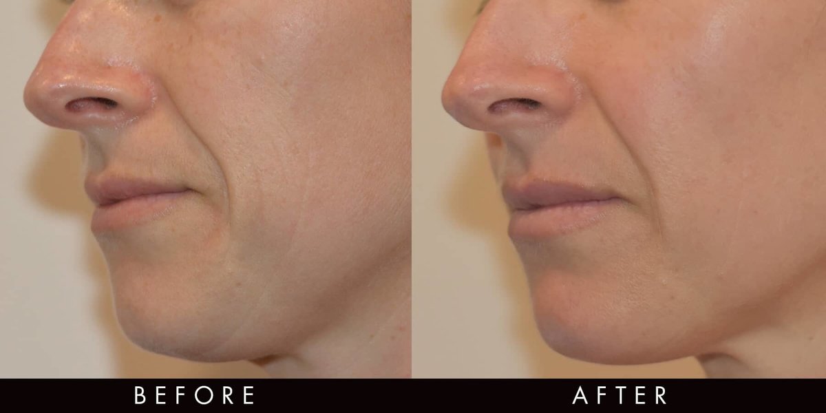 Vamp Cosmetic Clinic - Vamp Cosmetic Clinic