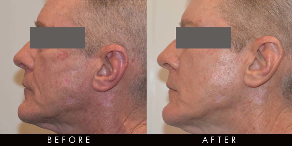 Vamp Cosmetic Clinic - Vamp Cosmetic Clinic