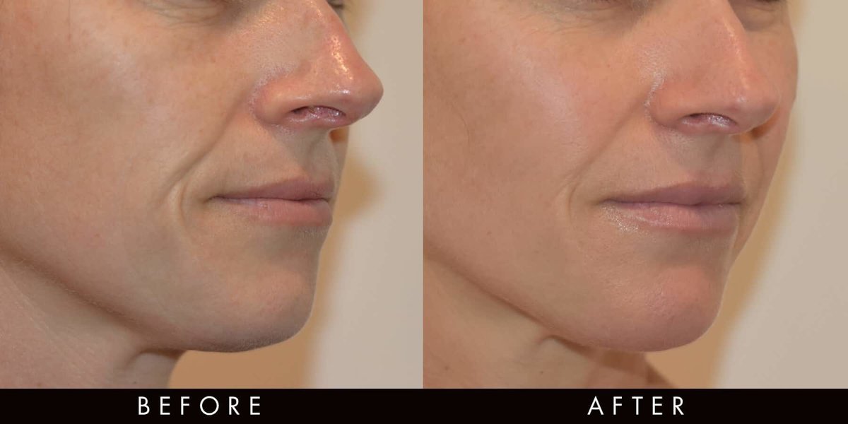 Vamp Cosmetic Clinic - Vamp Cosmetic Clinic