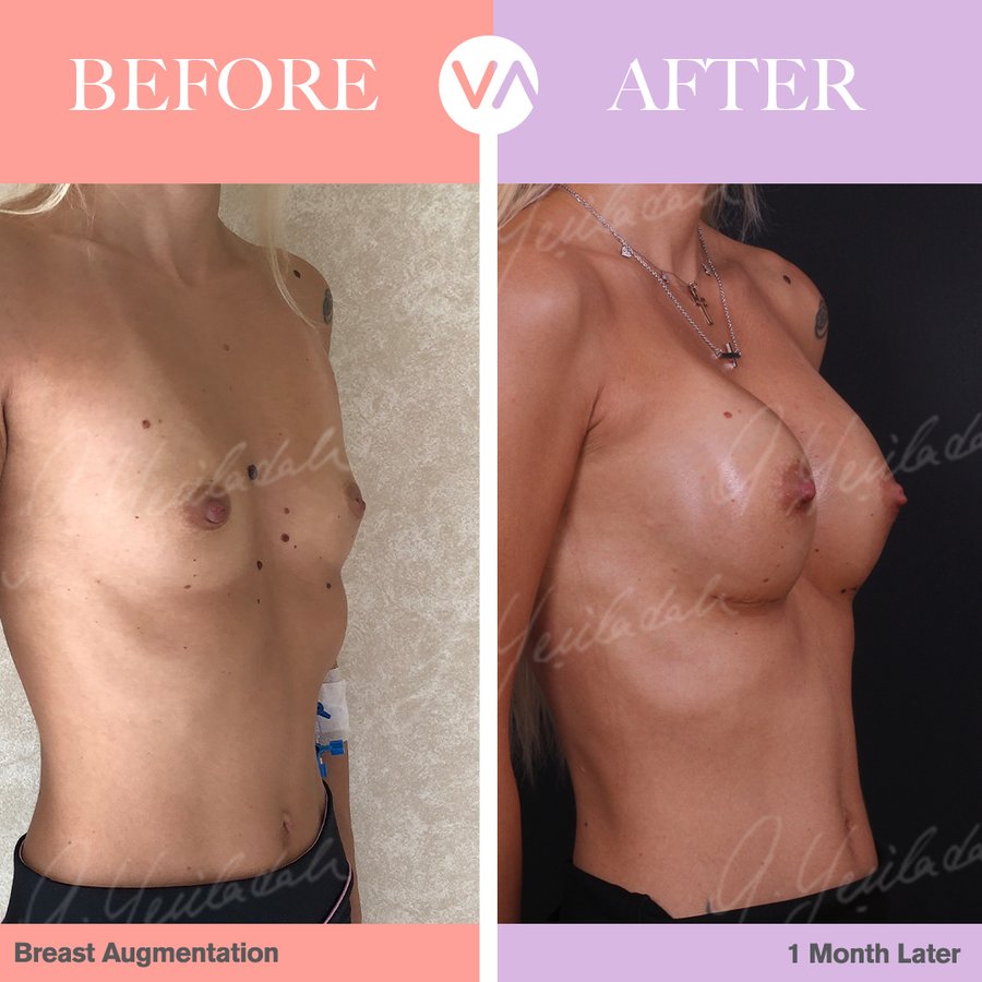 Vanity Cosmetic Surgery Hospital İstanbul - Vanity Cosmetic Surgery Hospital İstanbul