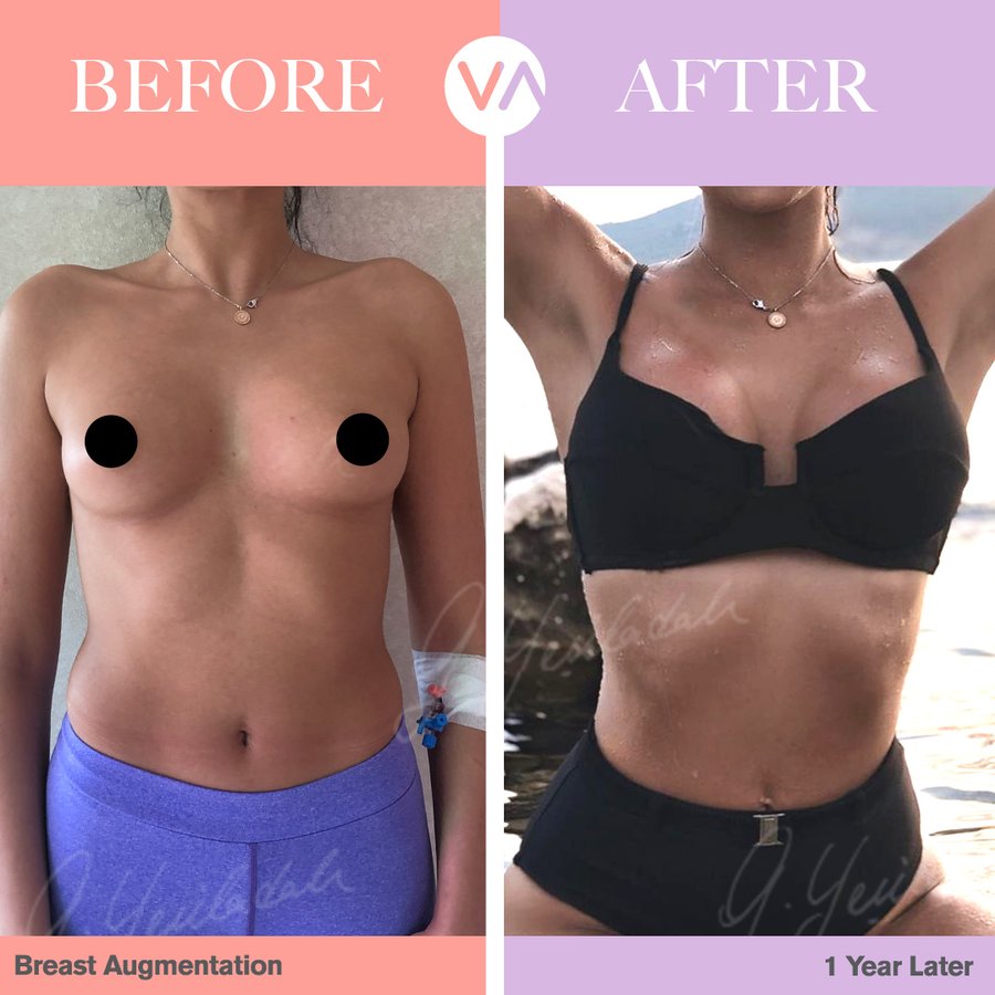 Vanity Cosmetic Surgery Hospital İstanbul - Vanity Cosmetic Surgery Hospital İstanbul