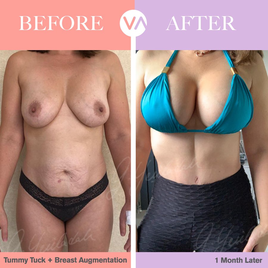 Vanity Cosmetic Surgery Hospital İstanbul - Vanity Cosmetic Surgery Hospital İstanbul