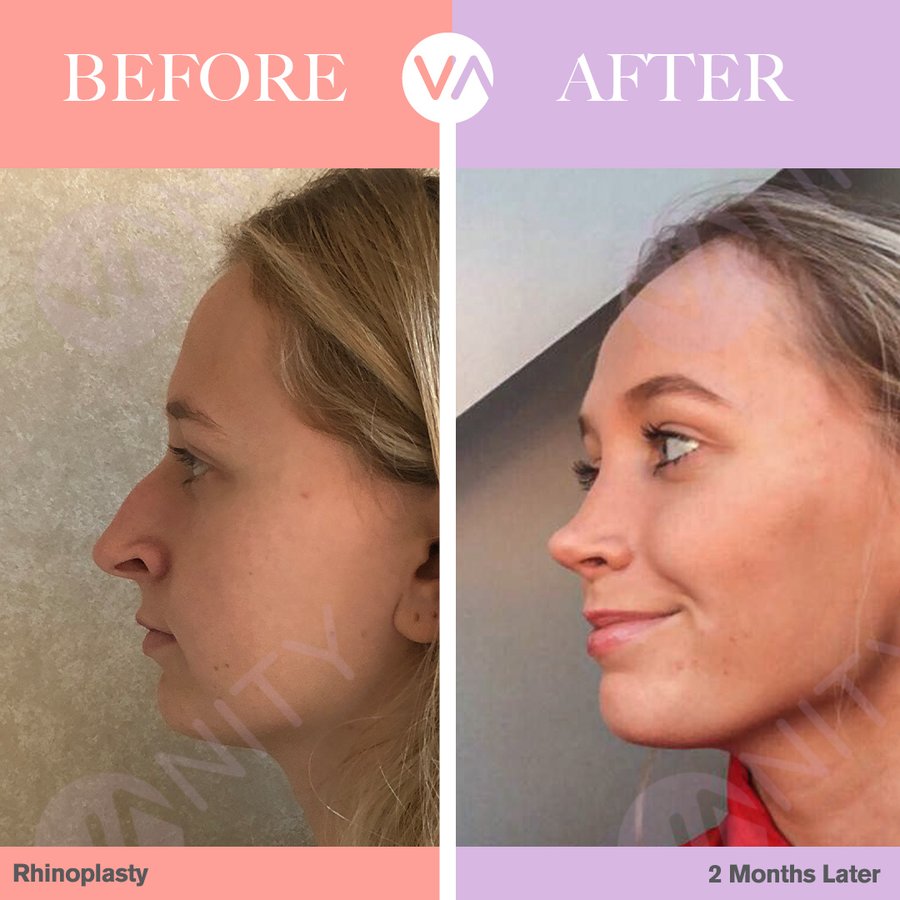 Vanity Cosmetic Surgery Hospital İstanbul - Vanity Cosmetic Surgery Hospital İstanbul